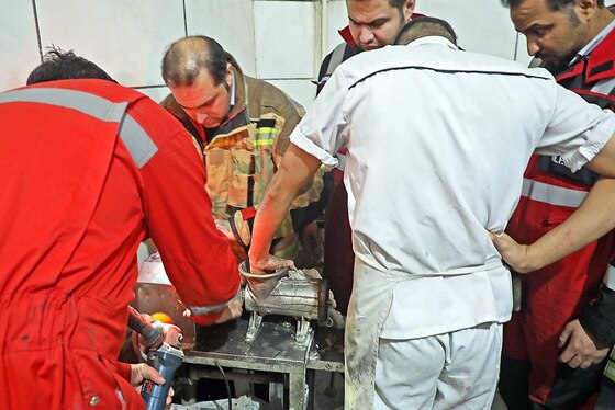 رها سازی انگشتان دست کارگر جوان مشهدی از داخل چرخ گوشت صنعتی + تصاویر