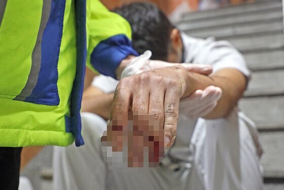 رها سازی انگشتان دست کارگر جوان مشهدی از داخل چرخ گوشت صنعتی + تصاویر