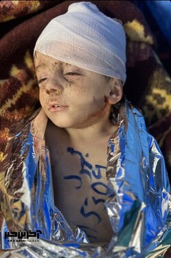 آخرین اخبار از حمله وحشیانه اسرائیل به بیمارستانی در غزه + فیلم و تصاویر