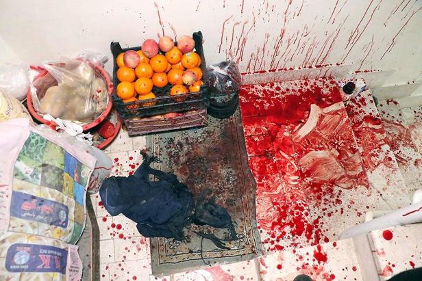 نخستین حادثه چهارشنبه‌سوری در مشهد با مجروحیت شدید جوان ترقه‌ساز+تصاویر