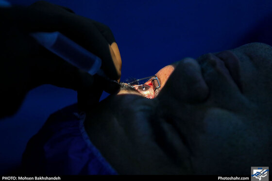 عمل جراحی سنتو لیزر در بیمارستان بینا - عکس : محسن بخشنده / شهرآرا