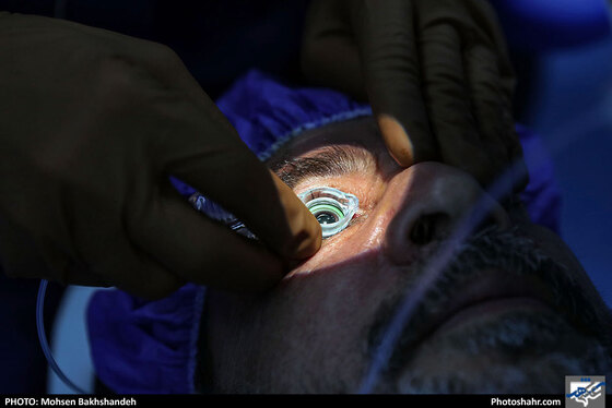 عمل جراحی سنتو لیزر در بیمارستان بینا - عکس : محسن بخشنده / شهرآرا